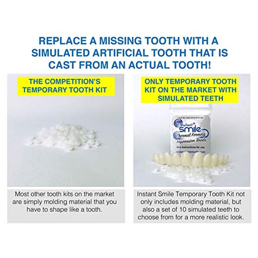 Instant Smile Temporary Tooth Kit